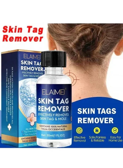 Skin Tag Remover
